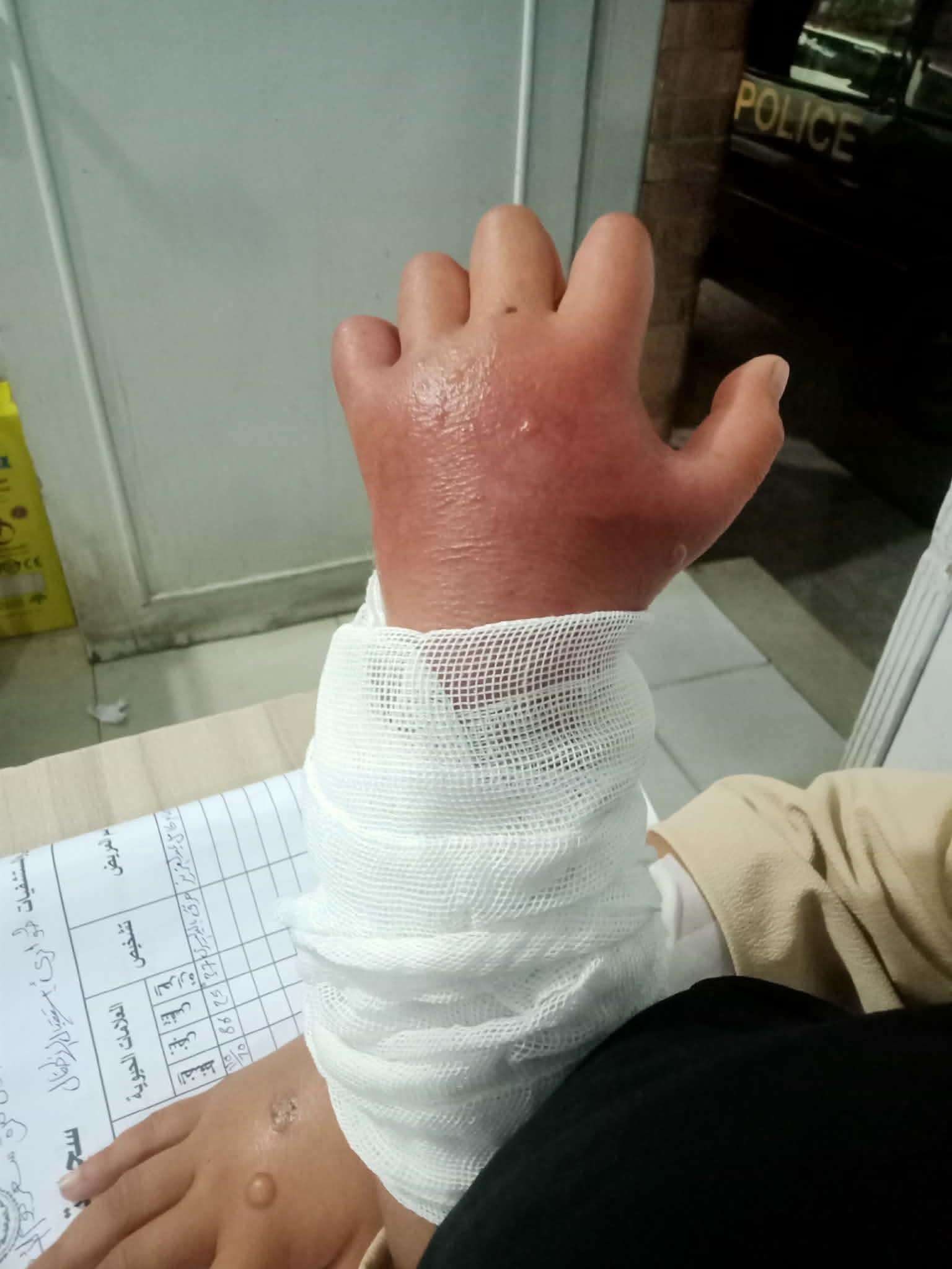 حبس أب عذب طفلته لطلبها شراء أدوات مدرسية بكفر الشيخ| صور