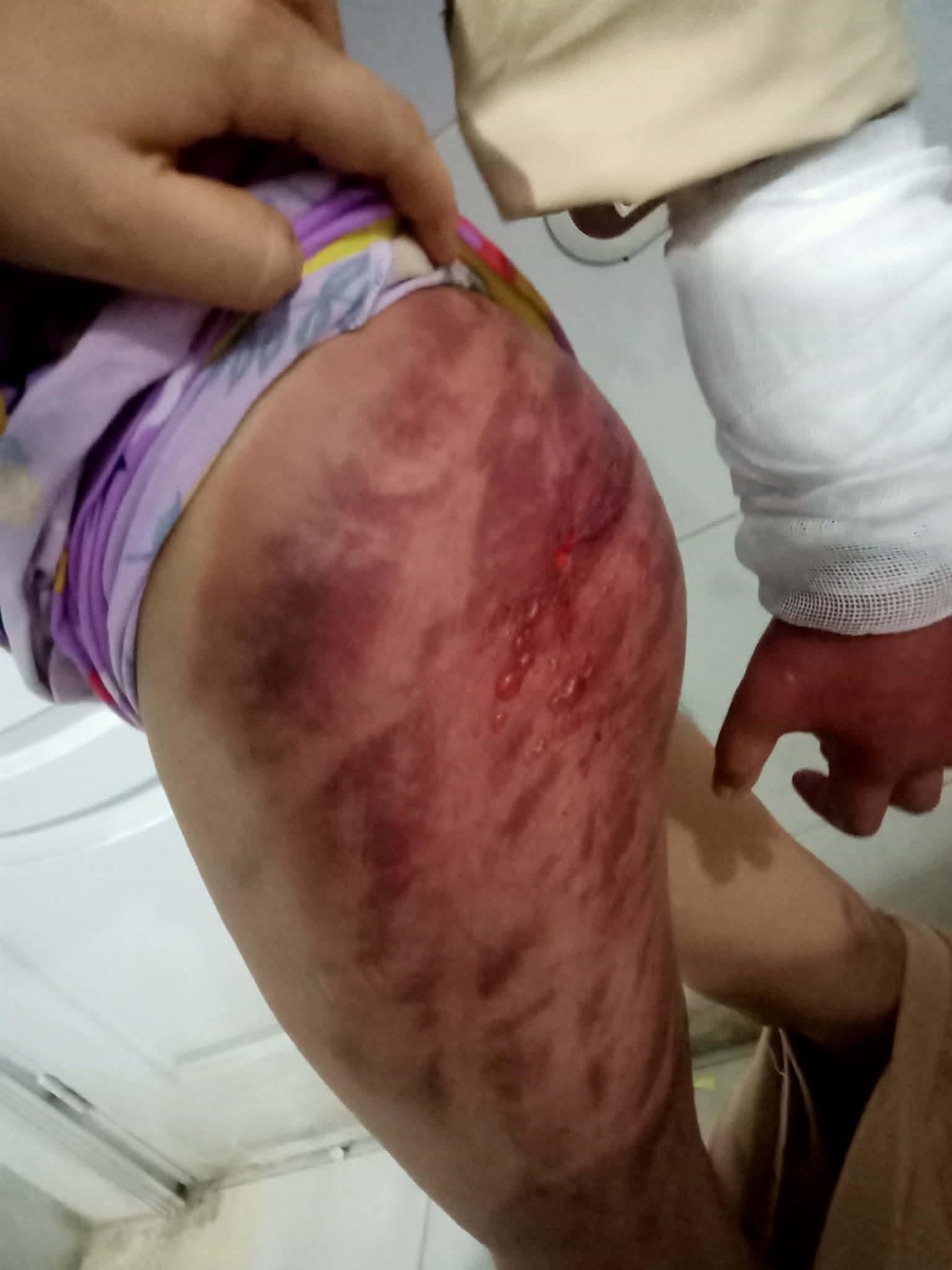 حبس أب عذب طفلته لطلبها شراء أدوات مدرسية بكفر الشيخ| صور