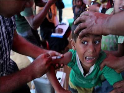 أكثر من 95 ألف حالة.. تفشي الحصبة في بنجلاديش