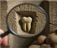 رحلة 5000 عام.. كيف تطور طب الأسنان من الفراعنة إلى العصر الرقمي؟