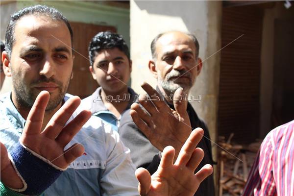  أكل العيش بـ«نصف أصابع»