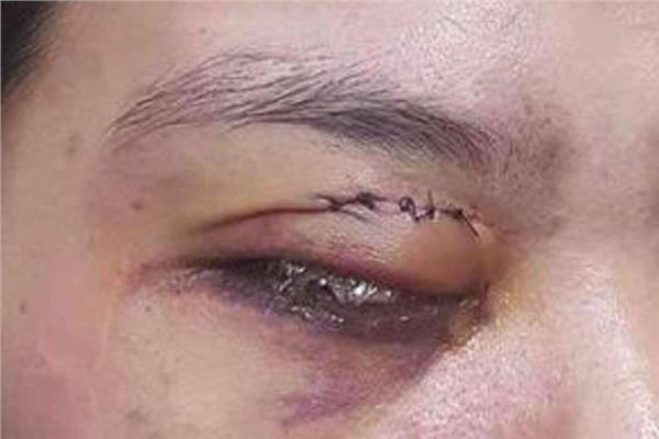 صورة موضوعية