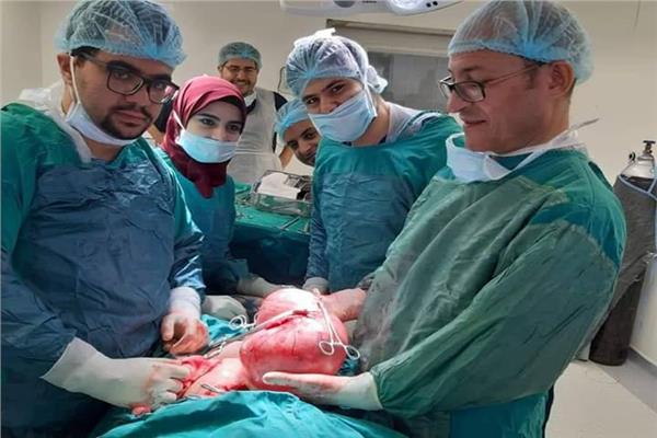 استئصال ورم بوزن ٣.٥ كيلو جرام