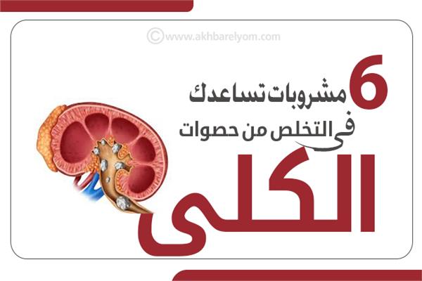 إنفوجراف | 6 مشروبات تساعدك في التخلص من حصوات الكلى