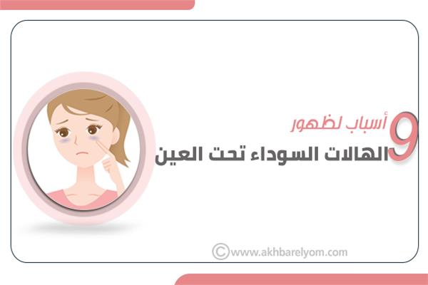 إنفوجراف | 9 أسباب لظهور الهالات السوداء تحت العين‎