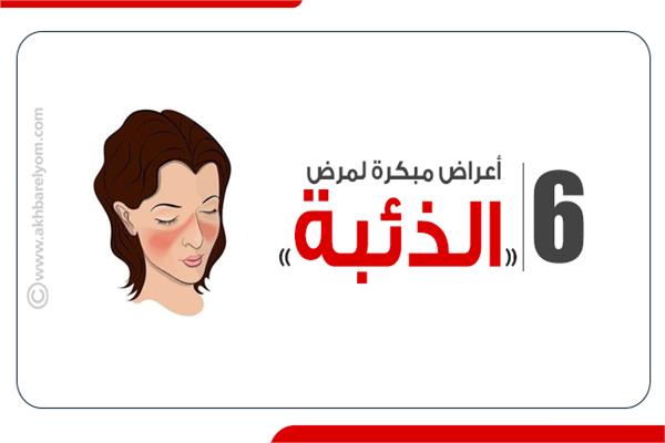 الذئبة