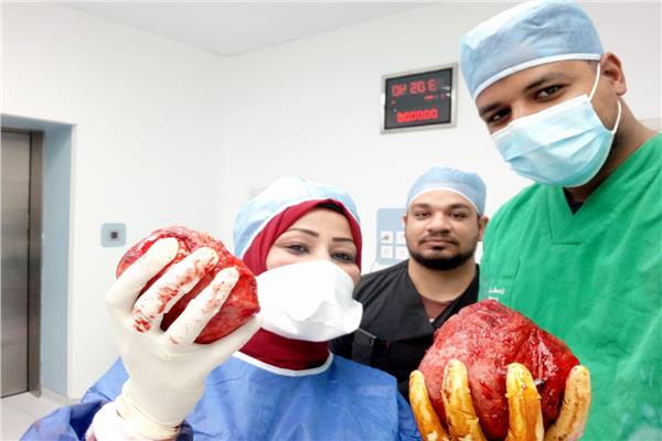 استئصال ورم ليفي يزن 4 كيلو