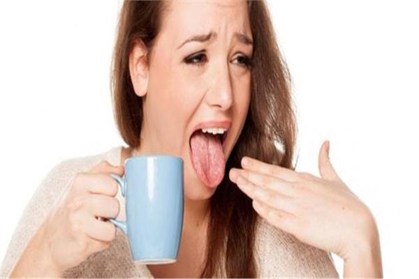 احتراق اللسان