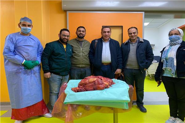 اورام جامعة أسيوط تستئصل ورم  خبيث منه يزن 30 كجم فى عملية جراحية 