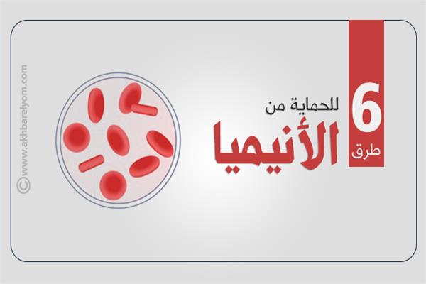 الأنيميا