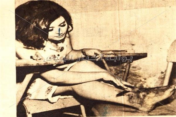 سعاد حسني بعد إصابتها بحروق في القدم - أرشيف أخبار اليوم