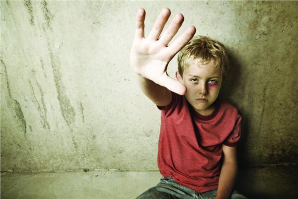 العنف ضد البراءة.. نماذج للإيذاء البدني من الآباء ضد أطفالهم | بوابة أخبار  اليوم الإلكترونية