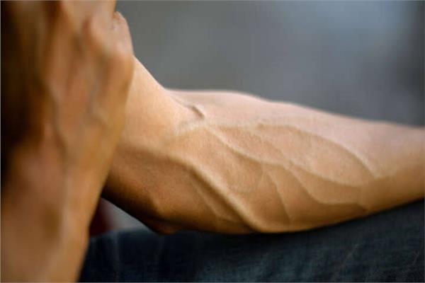  أستمرار تطور جسم الإنسان من الشريان الأوسط