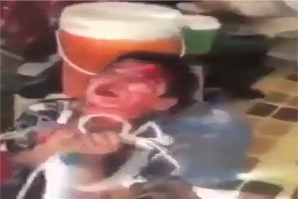 اثار التعذيب واضحة علي الطفل العراقي