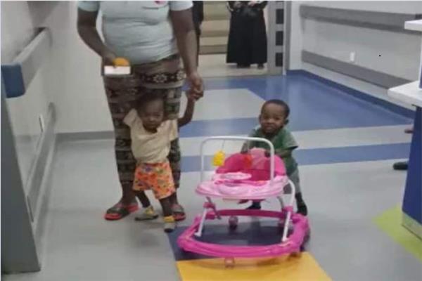 التوأم الملتصق يسيران على الاقدام