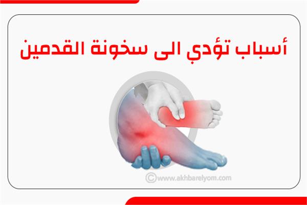 إنفوجراف | أسباب تؤدي الى سخونة القدمين