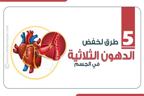  الدهون الثلاثية
