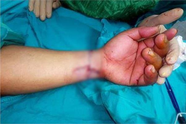 انتحار سيدة مسنة بقطع شرايين يدها والقفز من أعلى عقار بالتجمع الأول