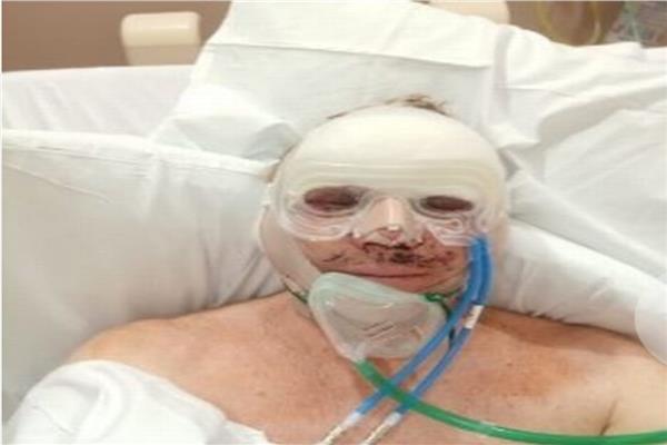 جراحة تجميلية فاشلة ..تسببت لمتقاعد غير قادر علي اغلاق عينيه لمده 3 سنوات
