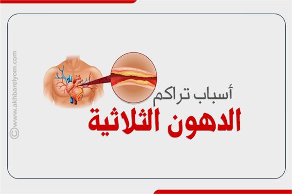 الدهون الثلاثية