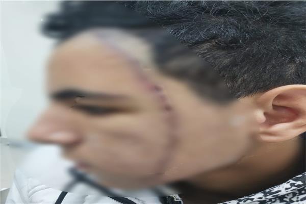 الطالب المصاب
