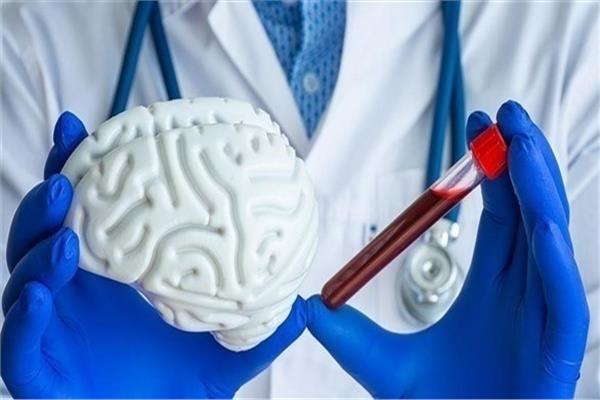ارتفاع الكولسترول المبكر عامل خطر للزهايمر