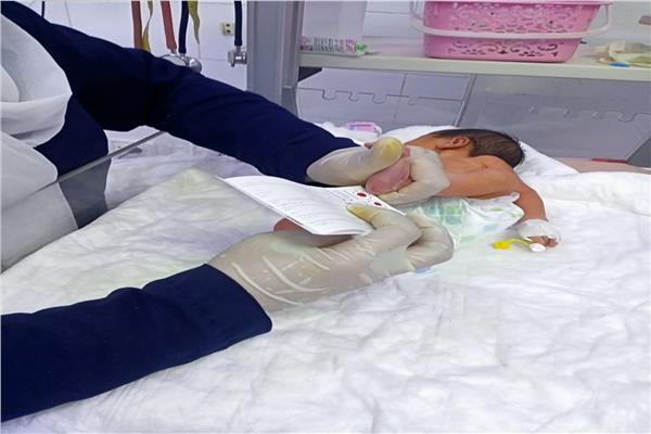 أطفال المبتسرين بالشرقية