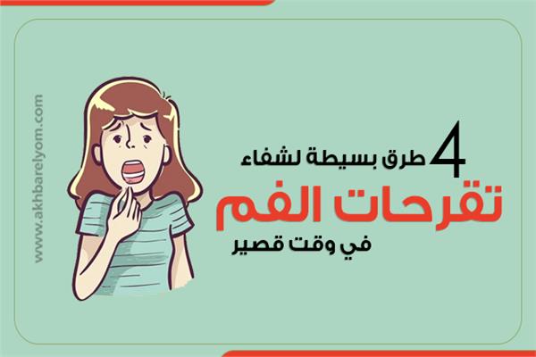 تقرحات الفم 