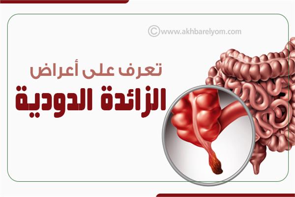 إنفوجراف|  تعرف على أعراض الزائدة الدودية