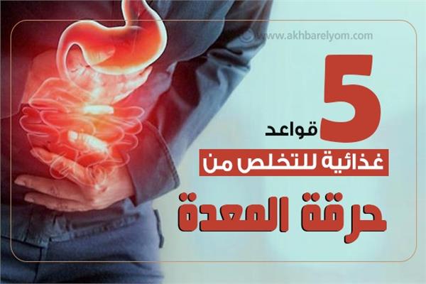  حرقة المعدة 