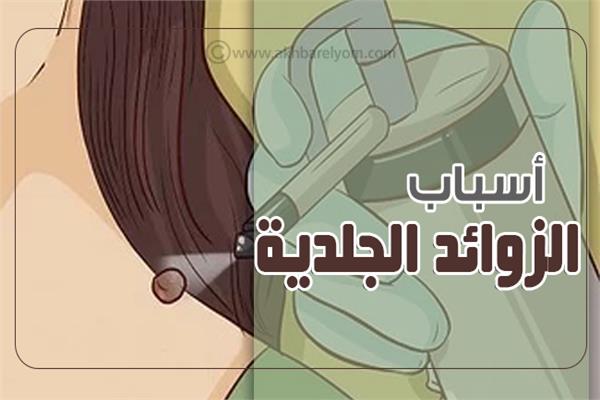 أسباب الزوائد الجلدية