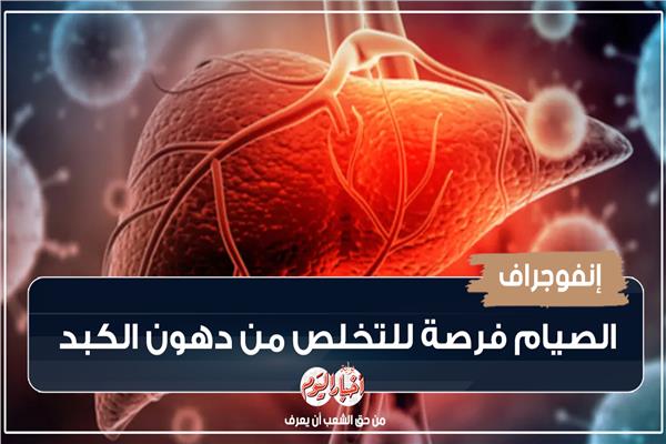 الإمساكية الصحية | الصيام فرصة للتخلص من دهون الكبد |إنفوجراف