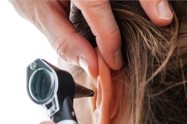 «مستعمرة عناكب» تعيش في أذن امرأة