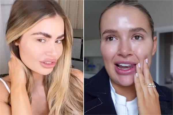 مشاهير بريطانيا يتخلون عن الفيلر والبوتوكس