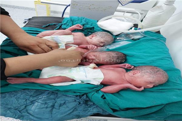 ٣ أطفال توائم 