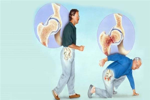 للوقاية من هشاشة العظام ..تعرف على الأطعمة التى يجب ان تتناولها