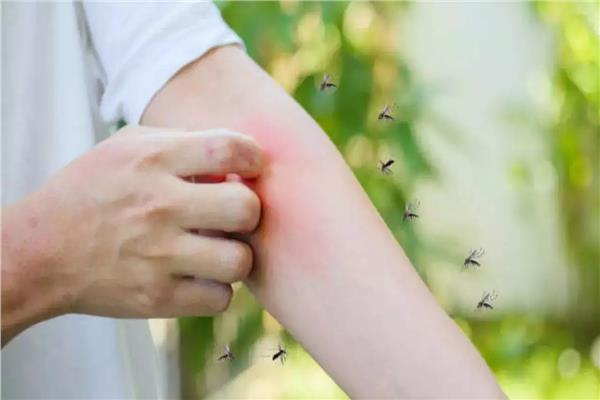 حمى الضنك الشديدة