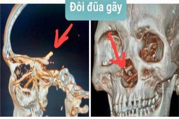 صورة موضوعية