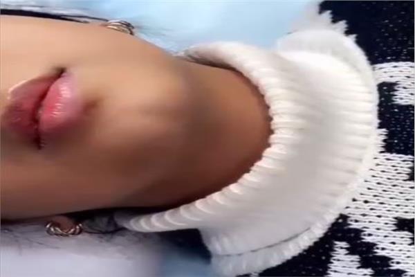 حقن طفلة بـ «فيلر شفاه»