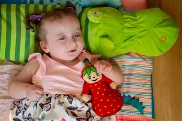  طفلة أمريكية تعاني من مرض نادر  طفلة أمريكية تعاني من مرض نادر 