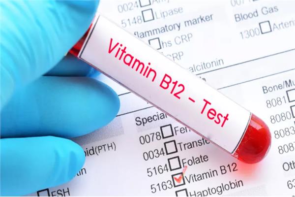 فيتامين B12