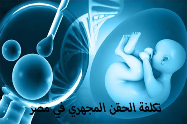 الحقن المجهري في مصر