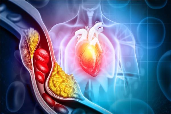 الدهون المتحولة الضارّة بالقلب