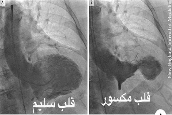 صورة موضوعية