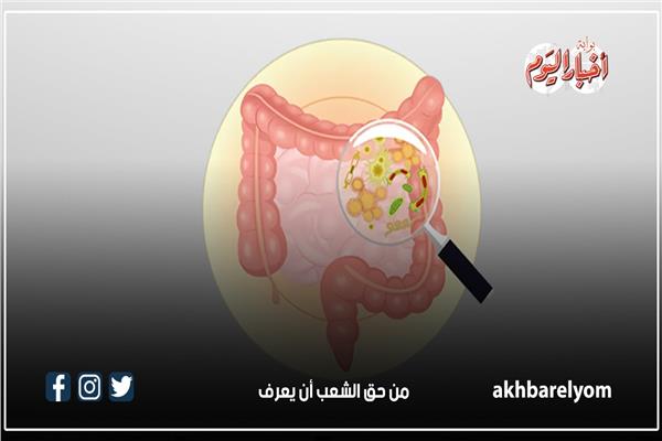 ميكروب «الايكولاي»