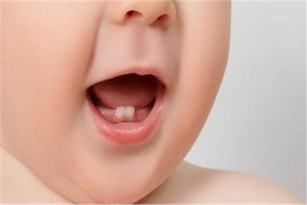 صورة موضوعية