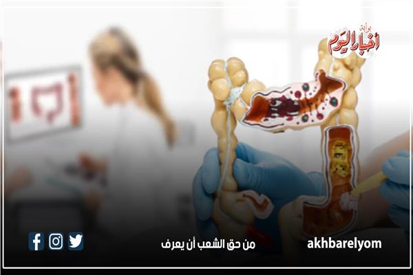 أطعمة تقيك من الإصابة بسرطان القولون 