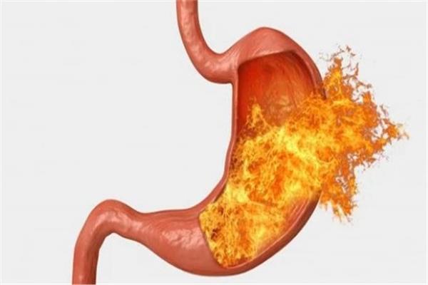 خطوات بسيطة لمنع ارتجاع المريء والحماية من السرطان