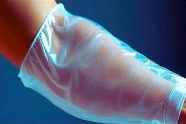 العلماء يخترعون هيدروجيل يحاكي جلد الإنسان لشفاء الجروح