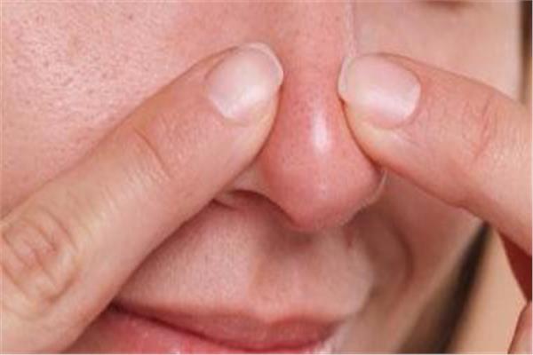 التخلص من الرؤوس البيضاء 